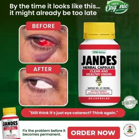 Jandes Herbal Capsule 9